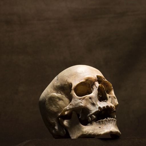 Human skull found in Batavia home ID'd as Indiana woman died in 1866