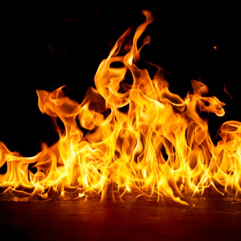 South Side man recovering from burns after setting his pants on fire last night