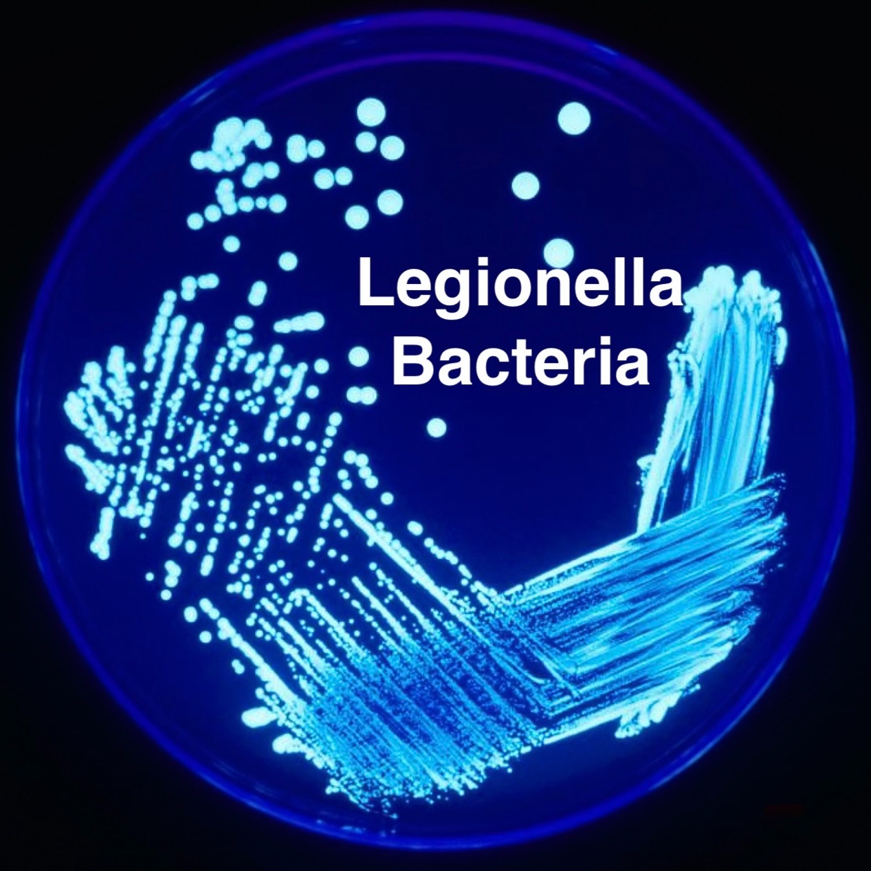 Legionella testing expands to Oakland County's Children's Village episode artwork