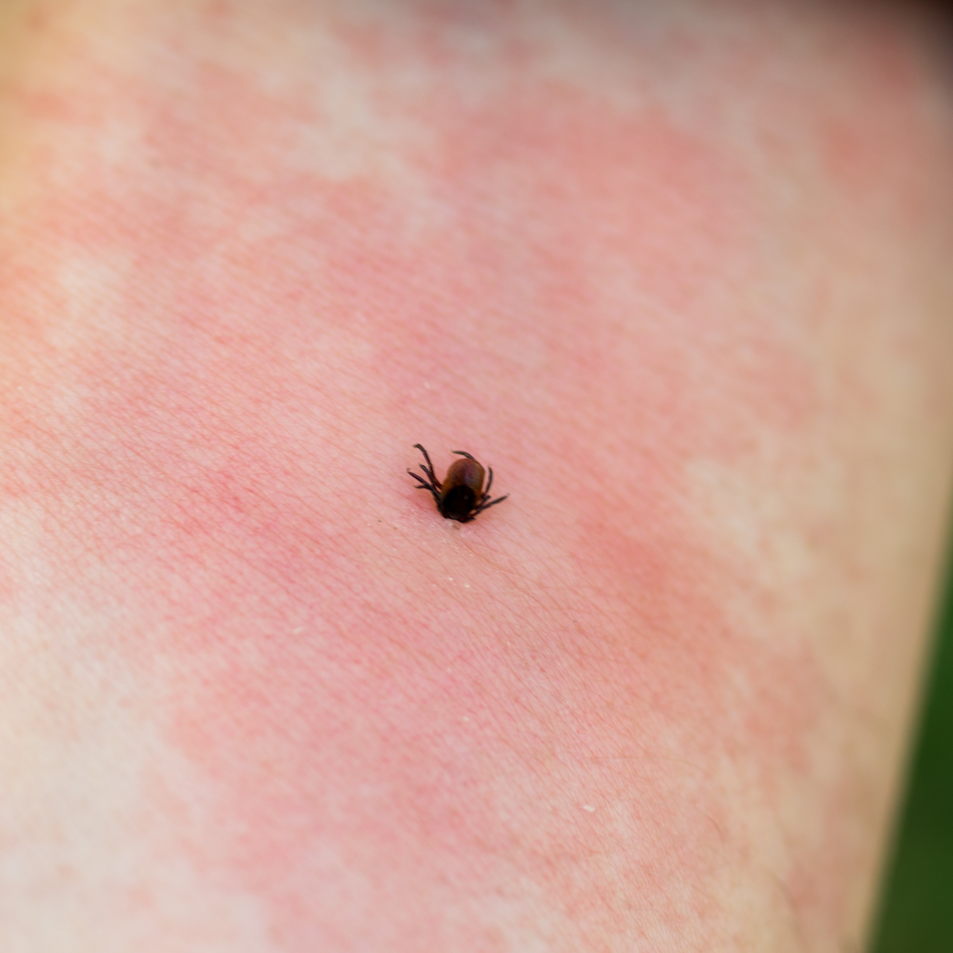 Tick-borne illnesses are on the rise in Michigan episode artwork