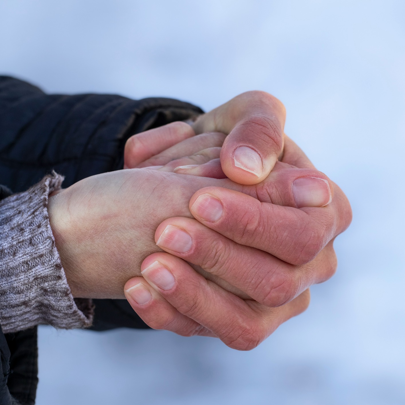 Talking Sleep with Dr. Stiehm, Bitter Cold/Frostbite with Jessie Nelson, MD! episode artwork