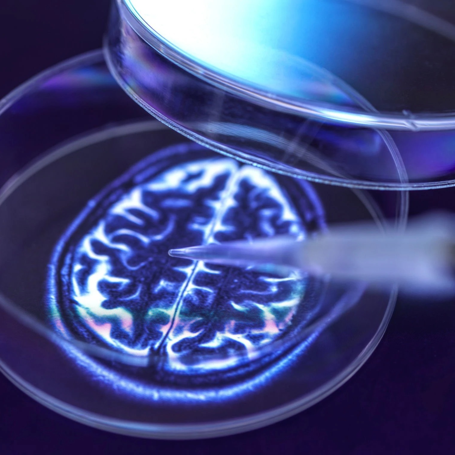 Weekly Dose and Ron Peterson, MD, PhD.. on Alzheimer’s and Dementia! episode artwork