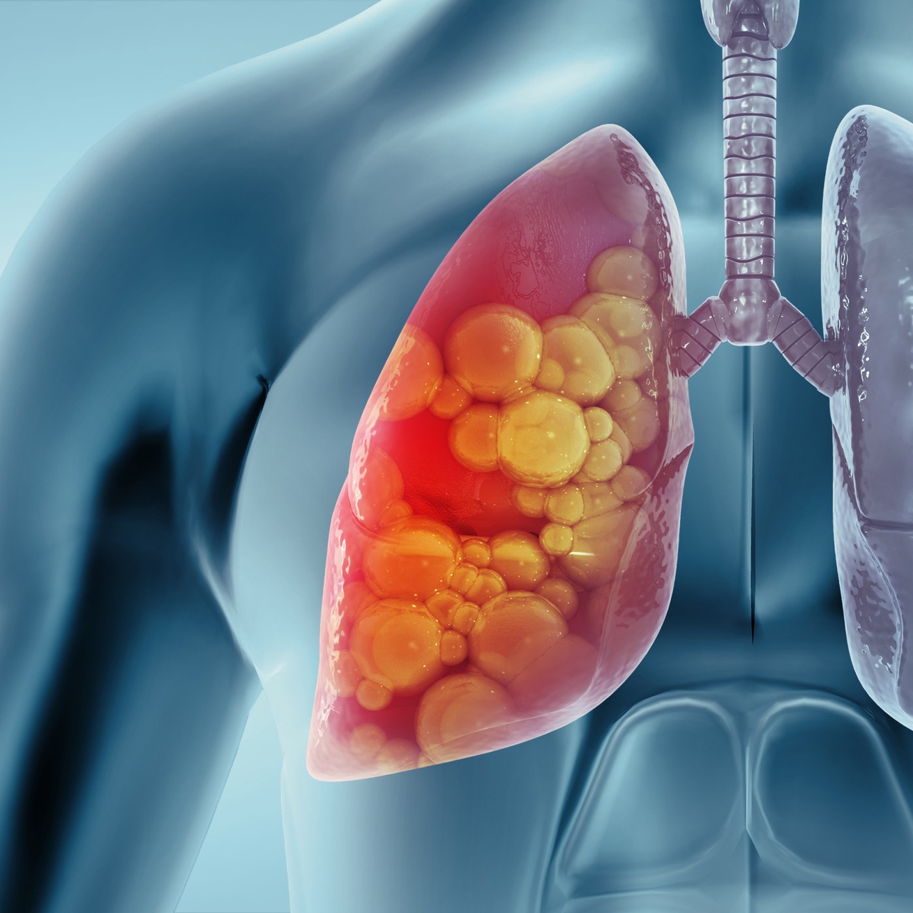 Lung and Pulmonary Health with A Breath of Hope! episode artwork