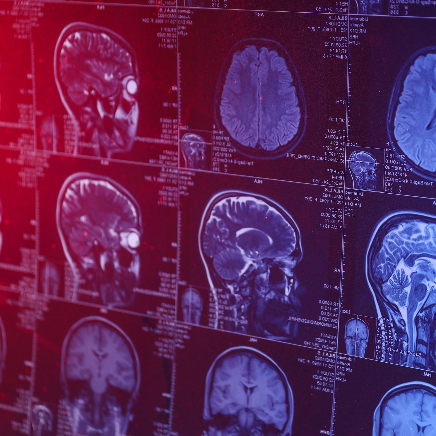 Dr. Sarah Song on maintaining brain health and neurology! episode artwork