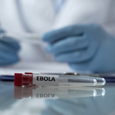 There's a big Ebola outbreak in Africa. Here's what you need to know episode artwork