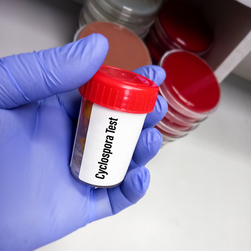 What you need to know about cyclosporiasis, the explosive diarrhea illness going around episode artwork