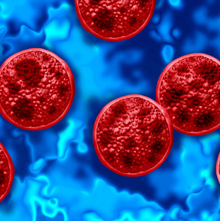 Hour 3: What to know about the cyclospora outbreak episode artwork