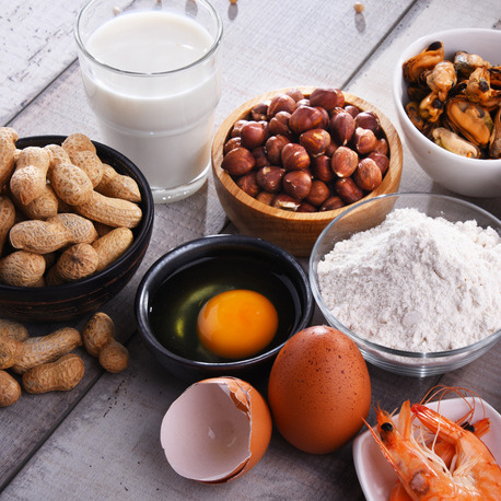 Everything a parent needs to know about food allergies and their kids episode artwork