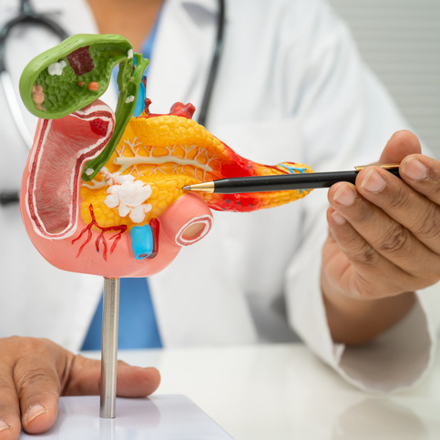 There's a new treatment for pancreatic cancer. Here's what to know episode artwork