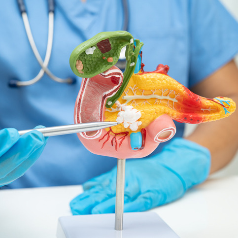 Pancreatic cancer is a terrible disease. Here's everything you need to know episode artwork
