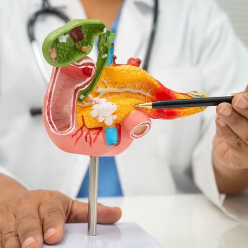 Hour 2: What you need to know about pancreatic cancer episode artwork