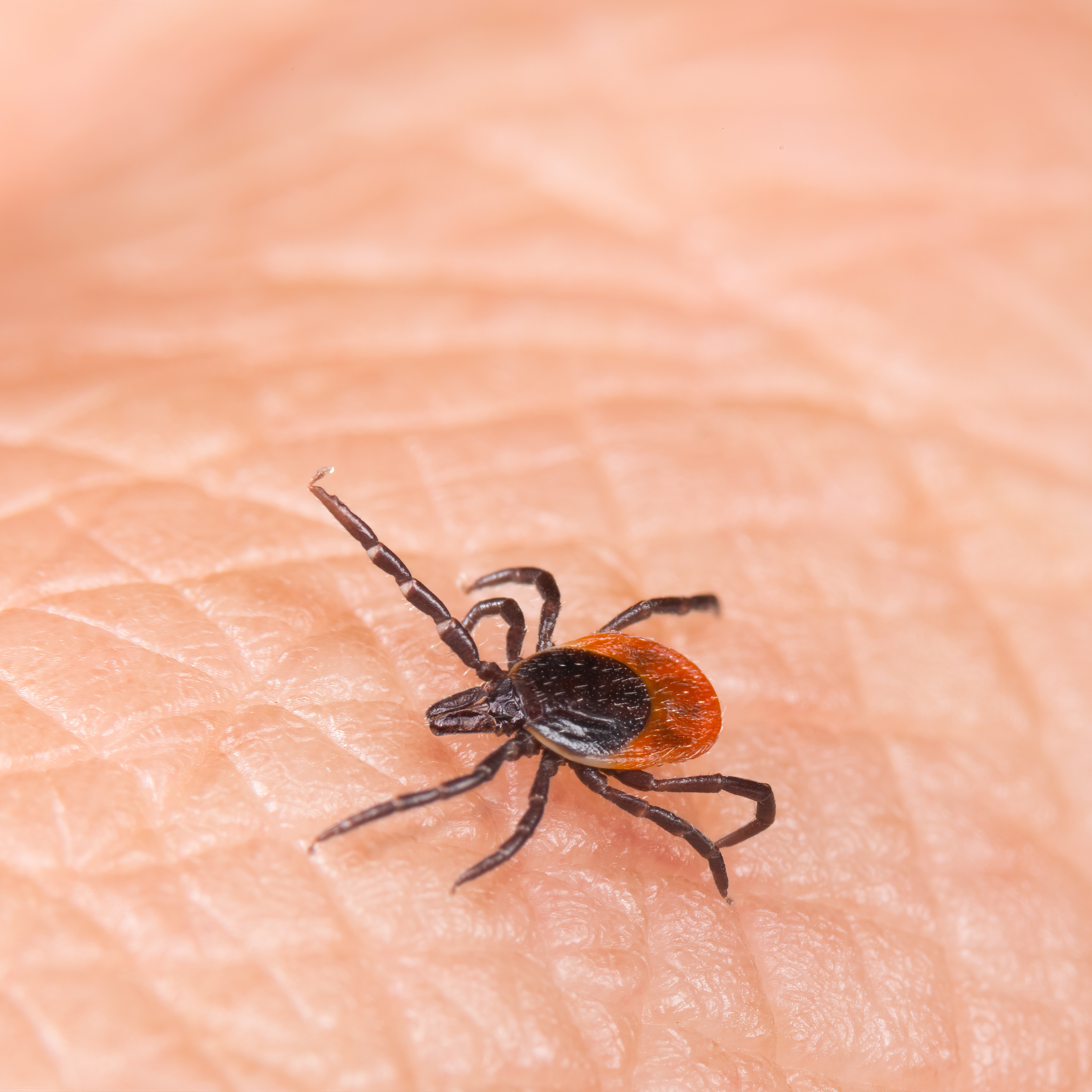 Health officials warn of worst tick season in nearly a decade episode artwork