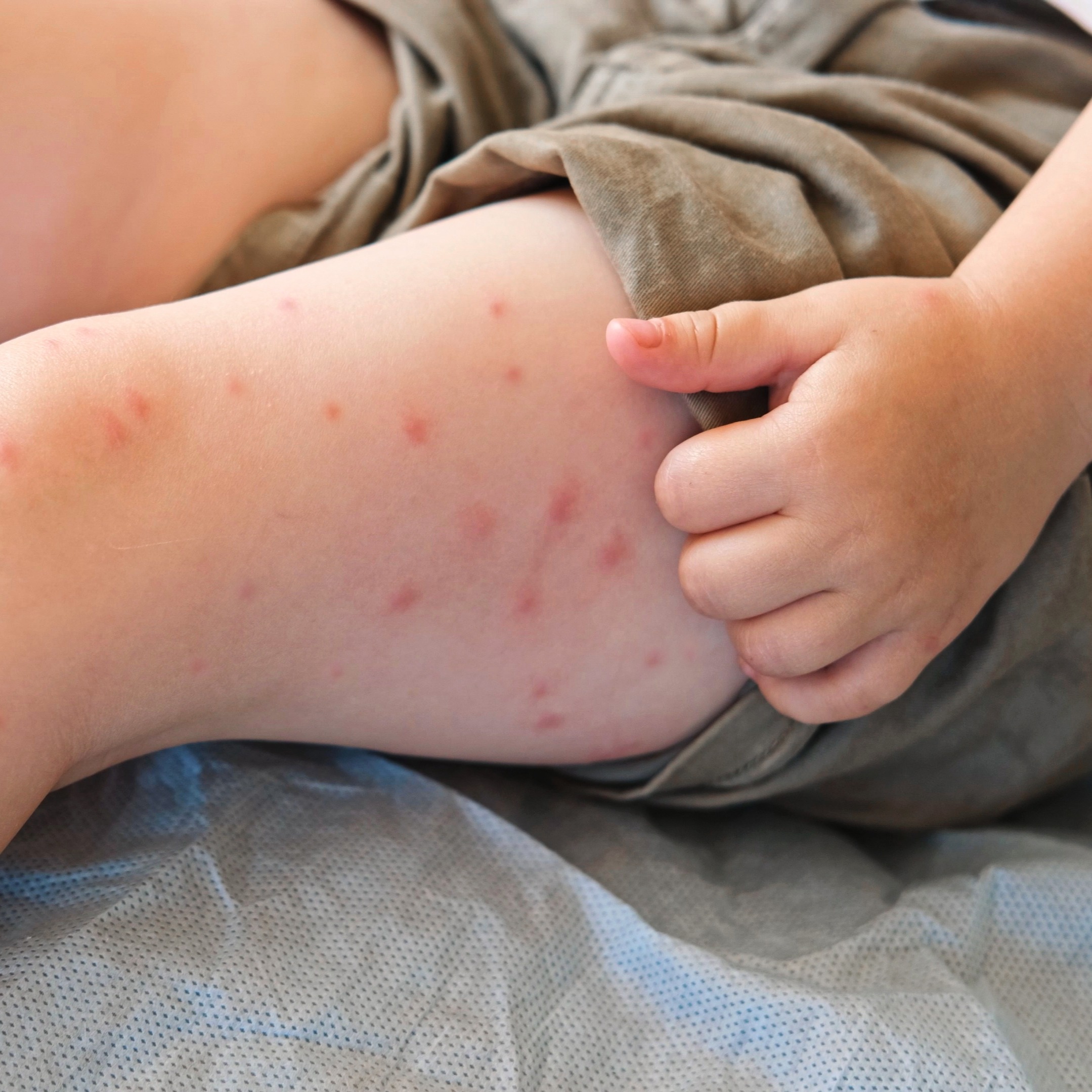 With measles cases on the rise, Pa. health officials recommend getting vaccinated to protect yourself and others episode artwork